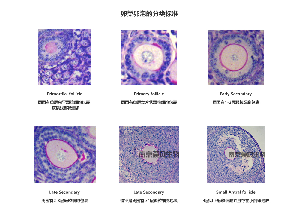小鼠卵巢各级卵泡计数(图1) 1-210P4114955O6.png